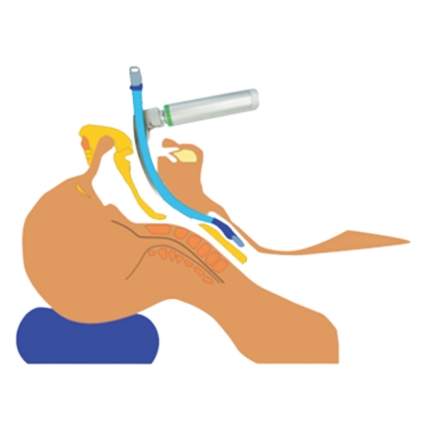 Why_to_choose_Haiye_fiber_optic_laryngoscopes_for_intubation_01.jpg